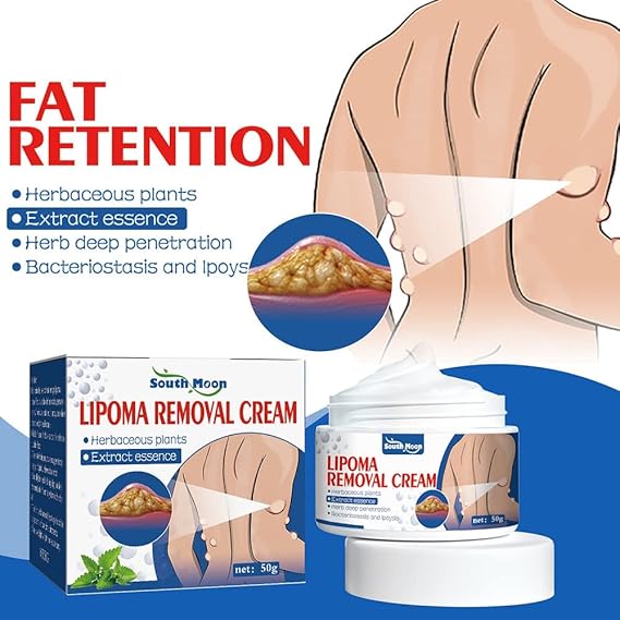 South Moon Lipoma Removal Cream {Buy 1 Get 1 FREE}