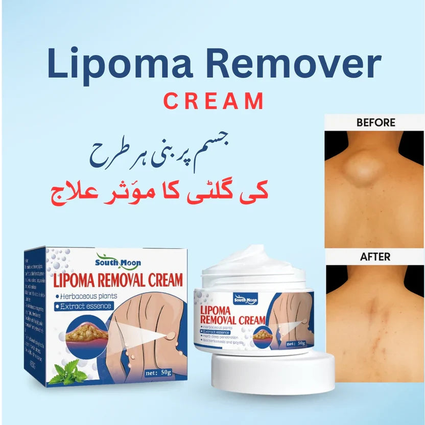 South Moon Lipoma Removal Cream {Buy 1 Get 1 FREE}