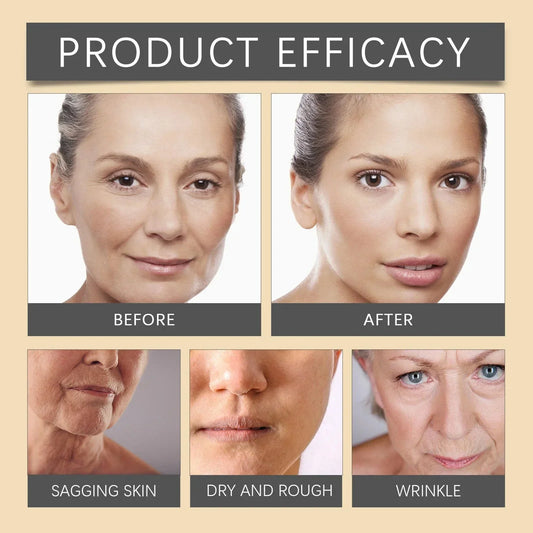 Botox Bee Venom Wrinkle Removal Cream ( Buy 1 Get 1 Free )