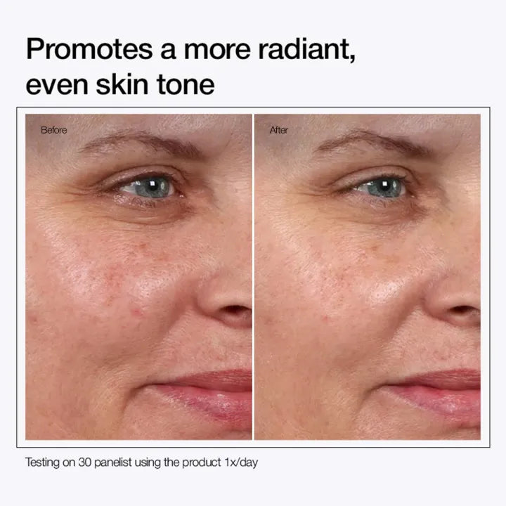 Urapara Glycolic Acid 7% (Buy 1 get 1 FREE)